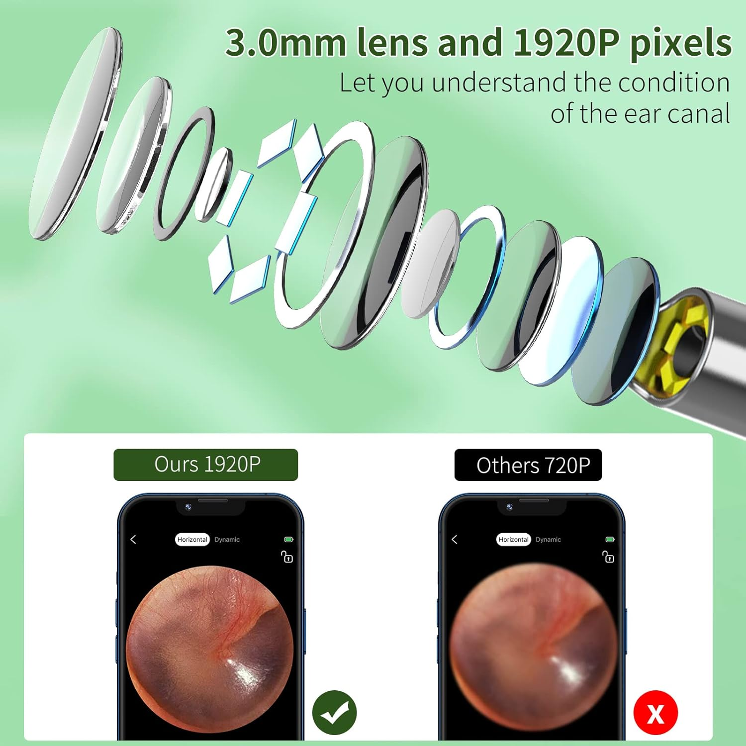 Wireless Ear Inspection Camera with 1920P HD Lens, 6 LED Lights and Cleaning Accessories – Black